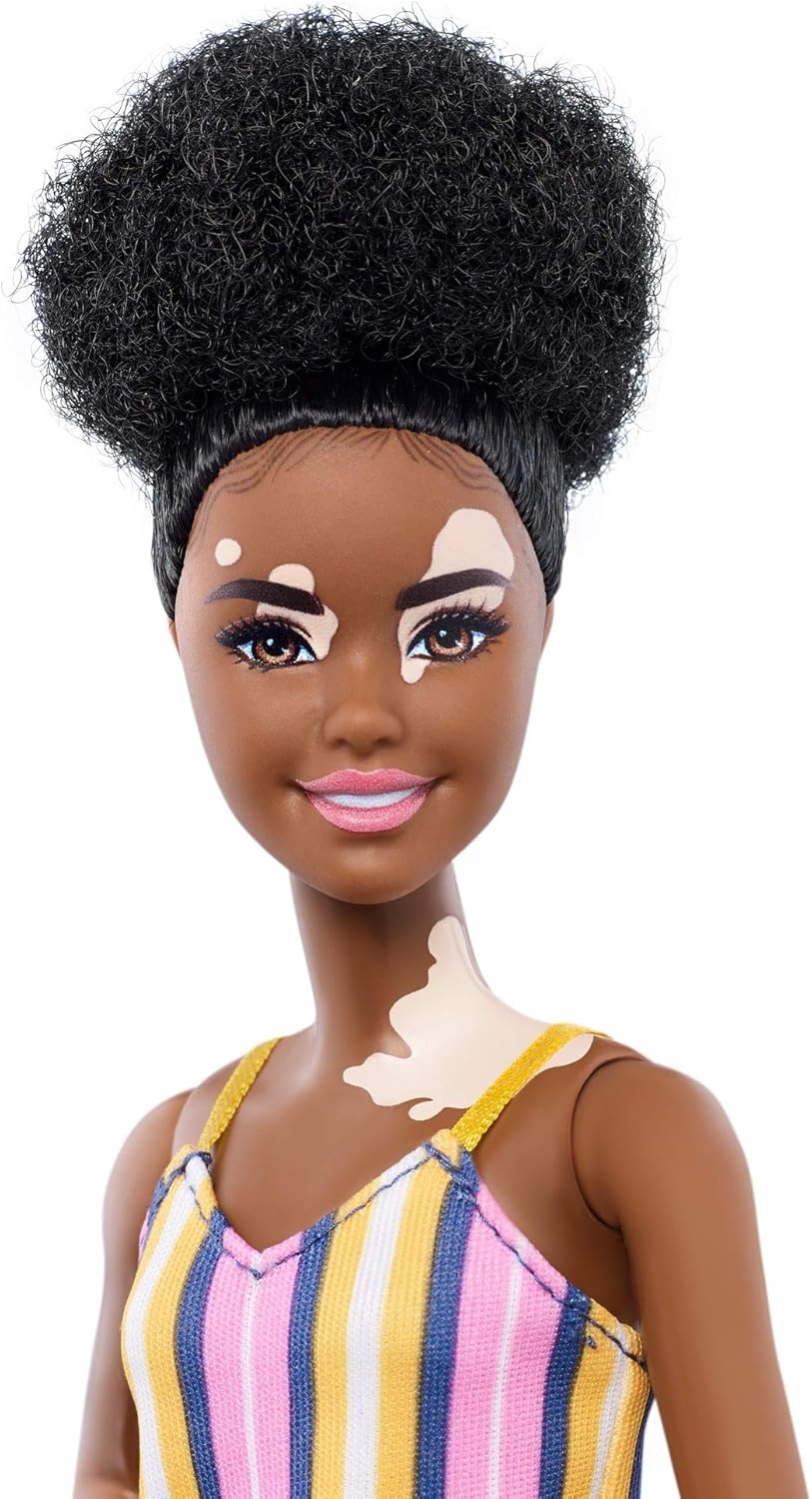 Barbie Fashionistas Vitiligo Doll with Striped Dress and Accessories (GYG08)