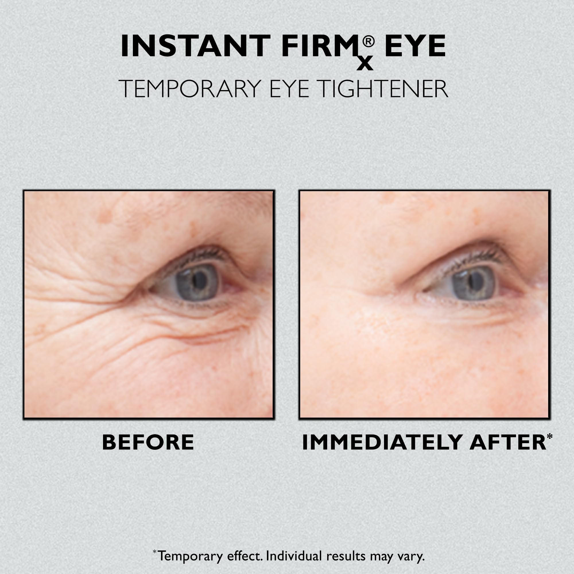 Peter Thomas Roth Instant FIRMx Eye Temporary Eye Tightener - Reduces Puffiness & Wrinkles | 15ml 8